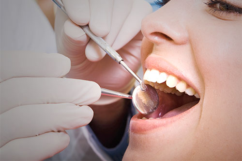 Refresh Your Smile This Winter With a January Dental Reboot